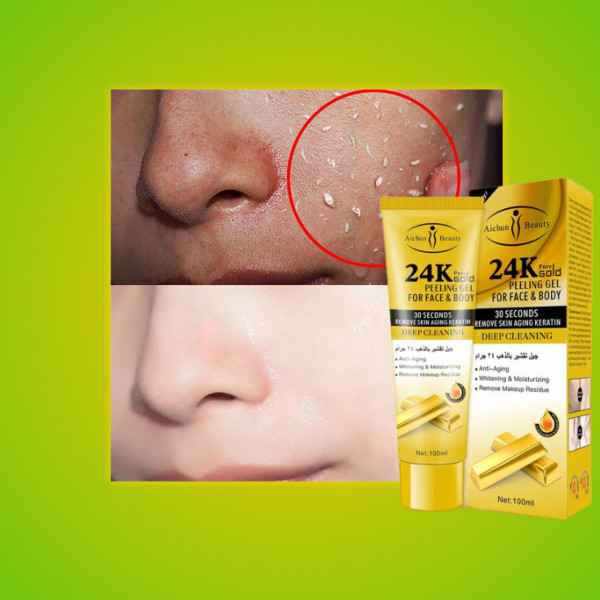 ads(2)